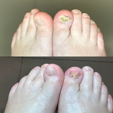 Erfahrung an der Notzung vu promicil Crème Barnabas aus Israel, Foto virum an duerno