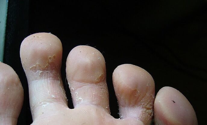 initial Etapp vum Pilz